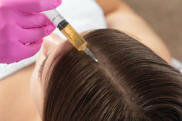 PRP Hair Treatment in Islamabad – A Modern Approach to Hair Restoration