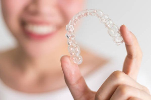 The Ultimate Guide to Teeth Retainers in Islamabad for Lasting Smile Results