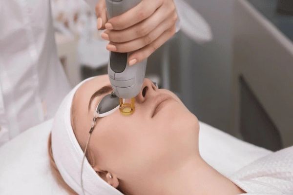 Fractional Laser CO2: Affordable Skin Solutions in Islamabad
