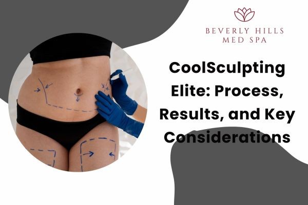 CoolSculpting Elite: Process, Results, and Key Considerations