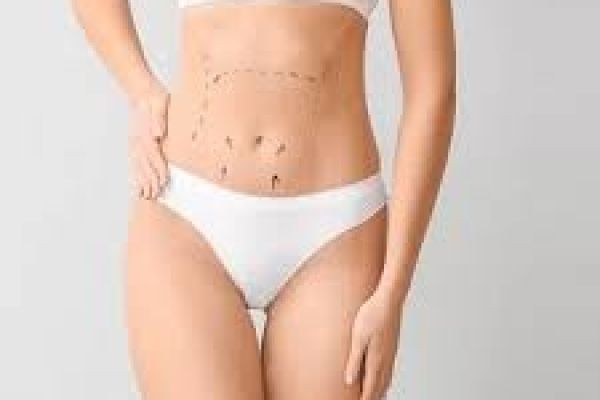 Complete Guide to Liposuction Surgery in Dubai for a Sculpted Body