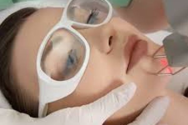 Fractional CO2 Laser Treatment in Dubai for Pigmentation and Sun Damage Repair