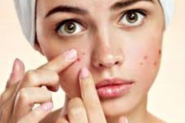 Pimple Treatment in Dubai for Oily and Sensitive Skin – Complete Skin Care Guide