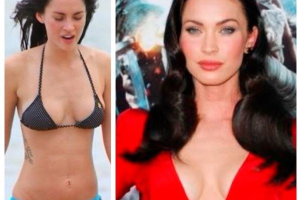 Megan Fox Plastic Surgery: Exploring the Truth Behind the Transformation