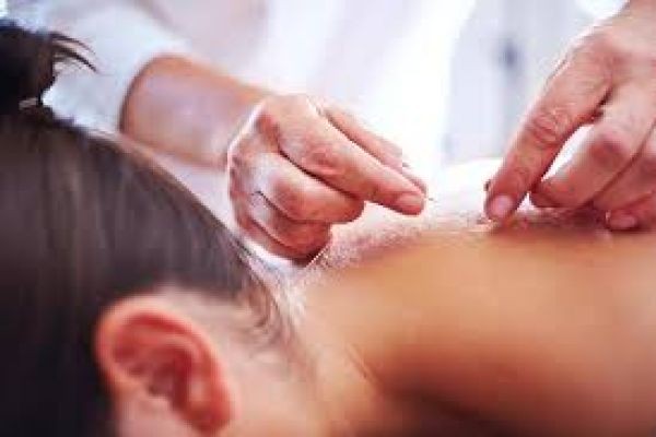 Acupuncture Treatment in Dubai for Natural Pain Relief and Holistic Wellness