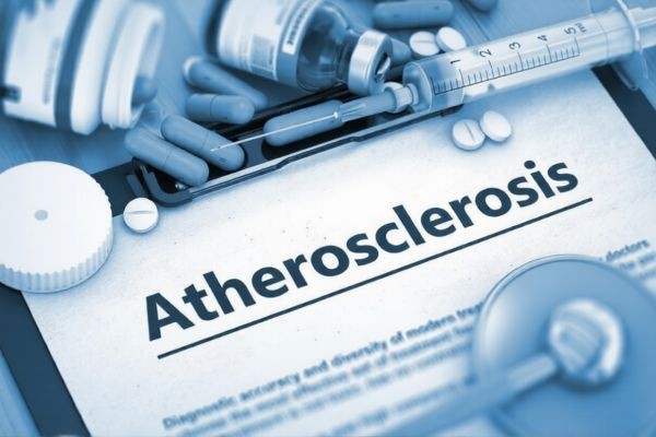 Atherosclerosis Drugs Market Barriers Insight Driven Analysis of Treatment Adoption Challenges