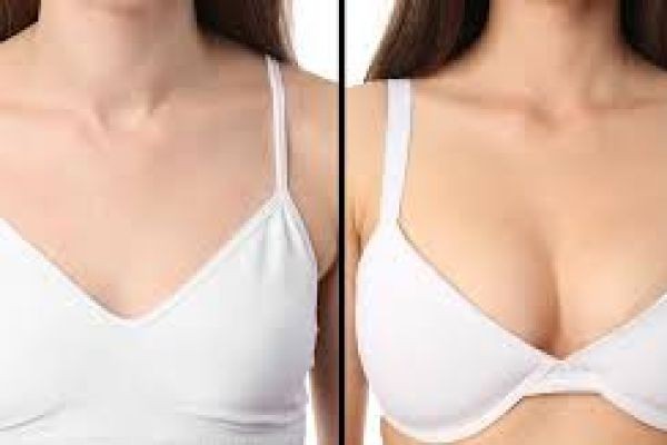 Breast Surgery in Dubai and the Art of Aesthetic Balance