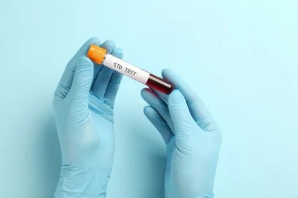 STD Test in Dubai: Advanced Diagnostics for a Health-First Lifestyle