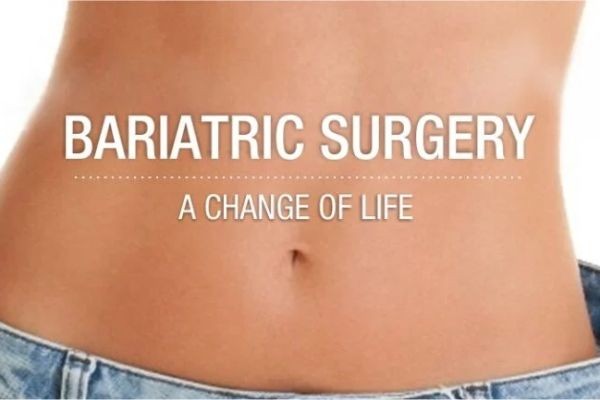Choosing the Best Clinic for Bariatric Surgery in Islamabad
