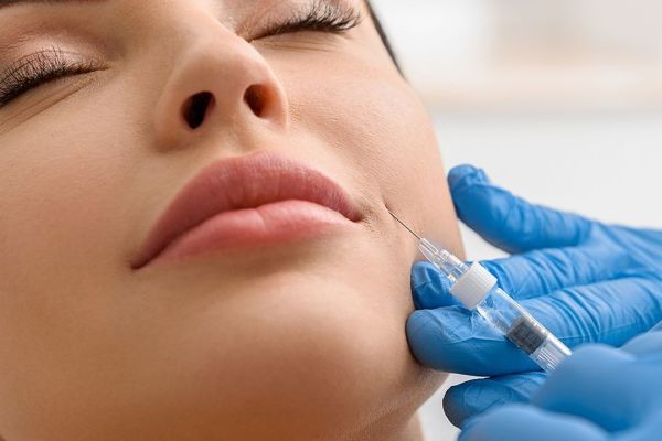 Fillers in Dubai: The Art of Subtle Facial Harmonization