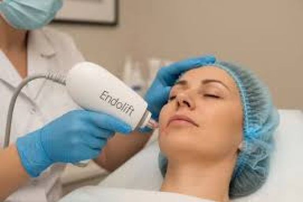 Endolift Treatment in Dubai: Advanced Non-Surgical Facial Sculpting Solution