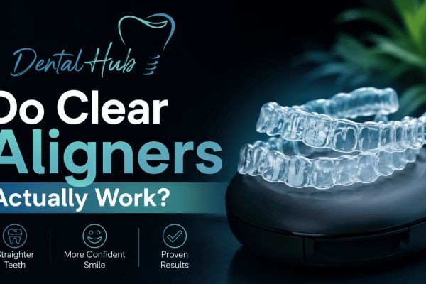 Do Clear Aligners Actually Work?