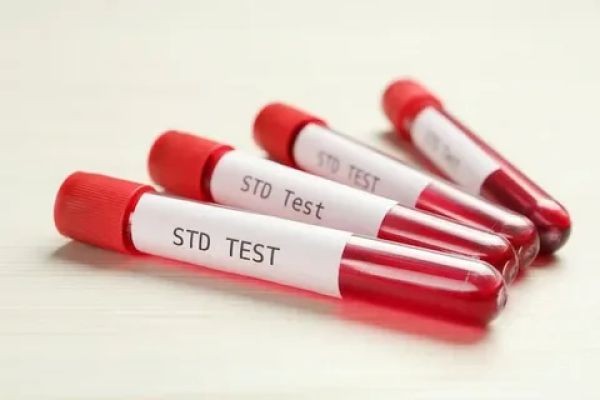 STD Test in Dubai: Peace of Mind Through Testing