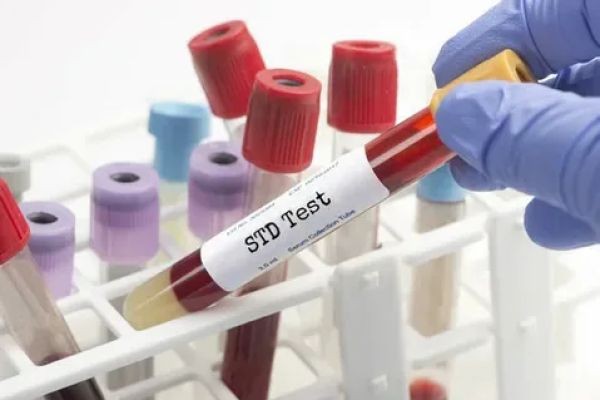 Personalized STD Test in Dubai for Maximum Privacy