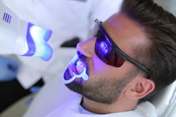 How Laser Teeth Whitening in Islamabad Removes Stubborn Stains