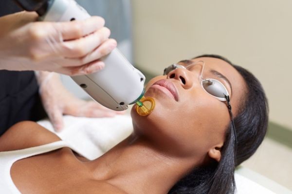 Laser Hair Removal and the Importance of Multiple Sessions