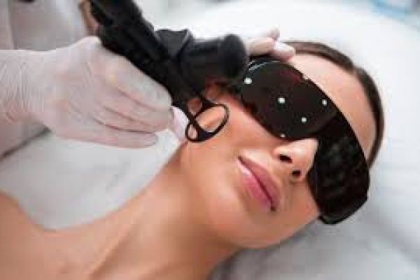 Fractional CO2 Laser Treatment in Dubai for Collagen Stimulation