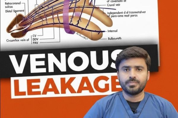 Venous Leak: Causes, Symptoms, Diagnosis, and the Best Treatment Options