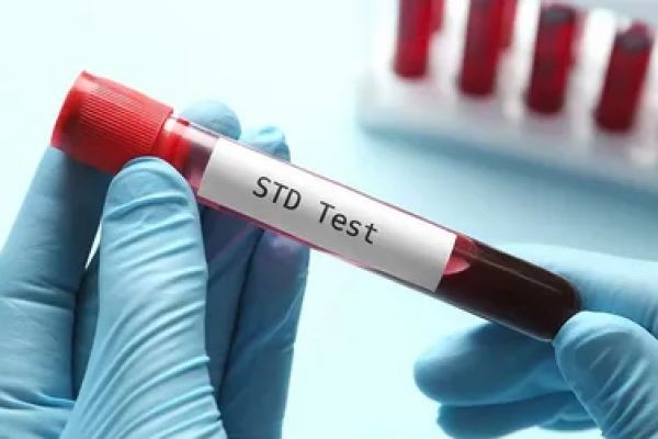 STD Test in Dubai: Your Journey to Better Sexual Health