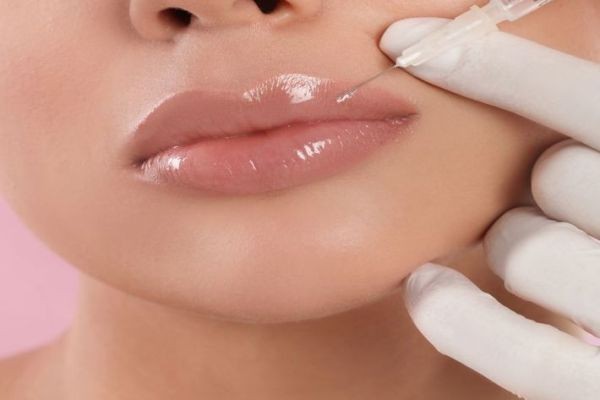 Smooth Lip Texture Solutions with Volbella Fillers For Lip in Dubai