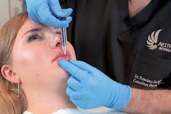 Understanding Lip Fillers Injections in Dubai for First-Timers – Safe Guide to Fuller Lips