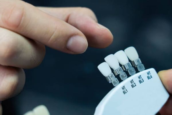 How Age Influences Cosmetic Dentistry Decisions Dental Veneers in Islamabad Pakistan: