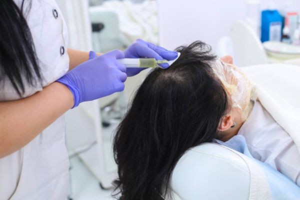 Why Scalp Health Is Essential for Hair Growth PRP Hair Treatment in Islamabad: