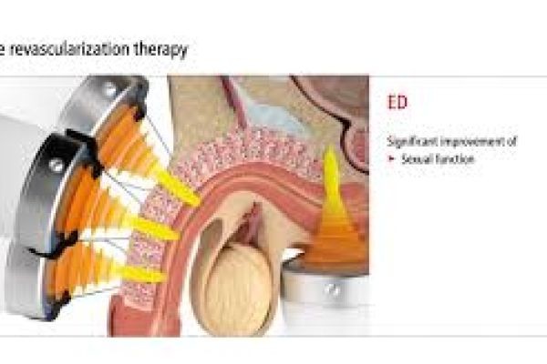 Improved Confidence with Erectile Dysfunction Treatment in Dubai Solutions