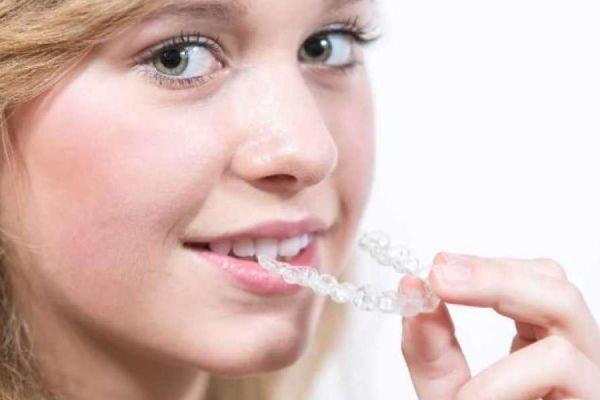 The Dental Implant Procedure – What Patients Can Expect