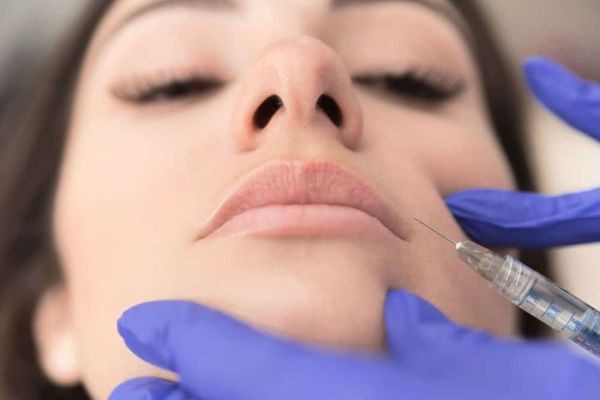 Lip Fillers Injections Aftercare Tips for Best Results