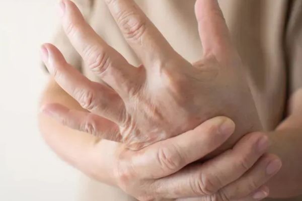 Osteoporosis: Understanding the Silent Threat to Bone Health