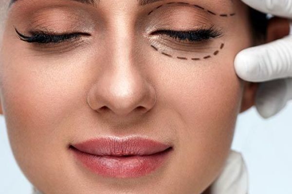Plexr Plasma Eye Lift in Dubai: Non-Surgical Eyelid Lift