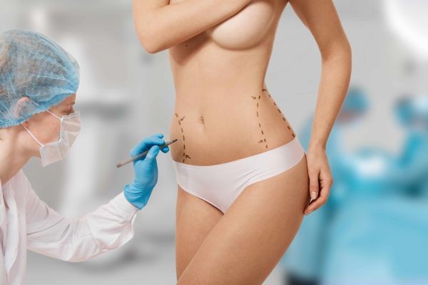 How Skin Elasticity Affects Liposuction in islamabad Results