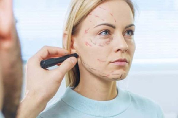Facelift in Islamabad: Before and After Transformation Guide