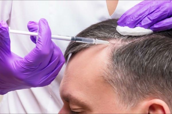 PRP in Islamabad: A Modern Solution for Hair Loss and Skin Rejuvenation