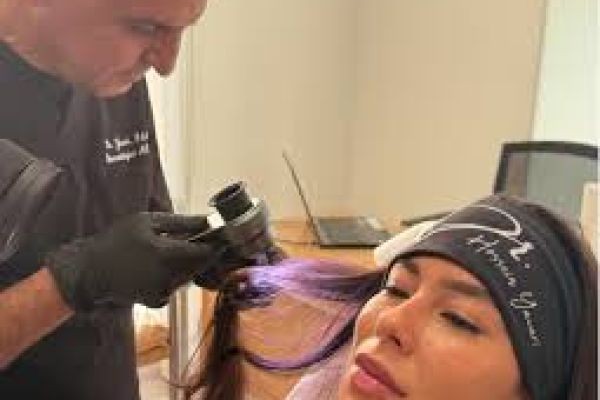 PRP Hair Treatment in Dubai: Before and After Expectations
