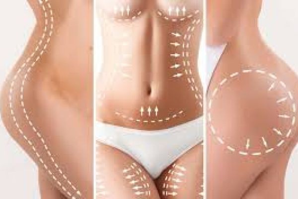 Mommy Makeover Dubai for Restoring Confidence and Body Shape After Pregnancy