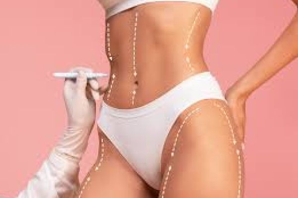 How Liposuction Surgery in Islamabad Can Help You Achieve Your Body Goals