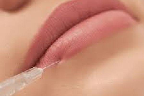 Advanced Volbella Fillers For Lip in Dubai for Smooth and Refined Lip Finish