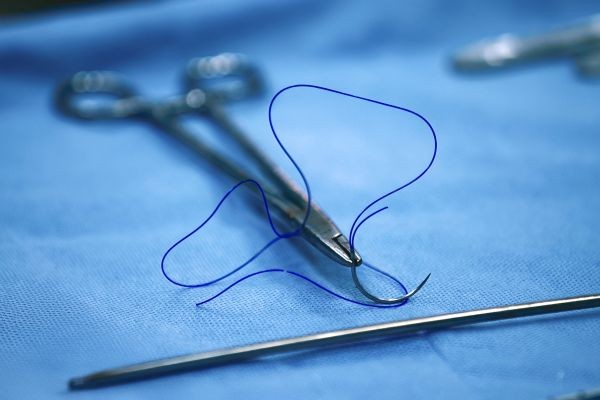 Why Suture Removal at Home in Dubai Is Becoming More Popular