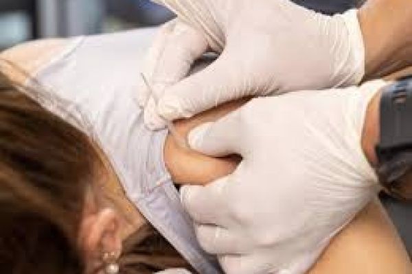 Acupuncture Treatment in Dubai for Better Sleep and Relaxation