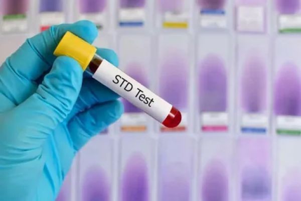 STD Test in Dubai: Comprehensive & Private Care