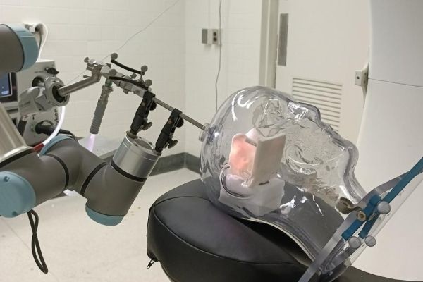 Neurosurgical Robotics Market Overview Tracking Emerging Trends In Advanced Brain Procedures