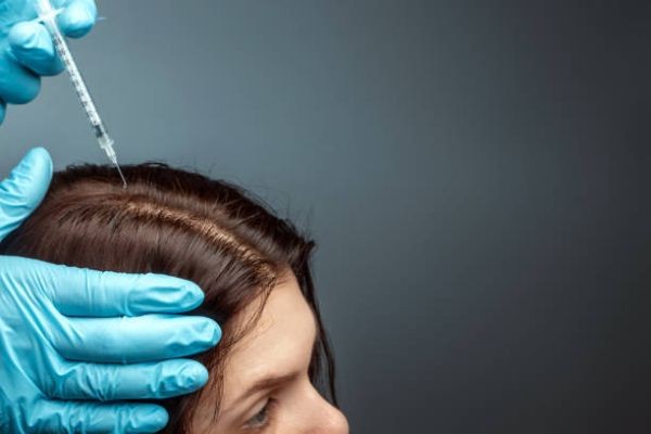 Exosome Hair in Dubai: Why Personalized Protocols Work