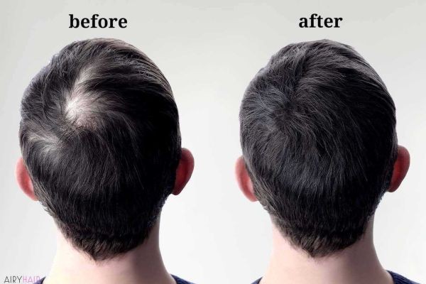 Mens Hairpieces- Transform your look to suit the occasion