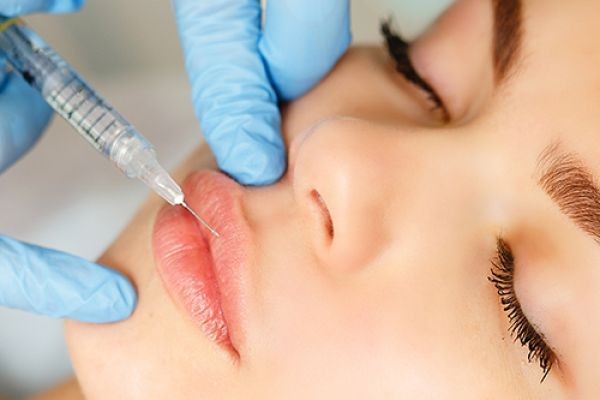 Before and After Guide to Lip Fillers Injections in Dubai: What to Expect