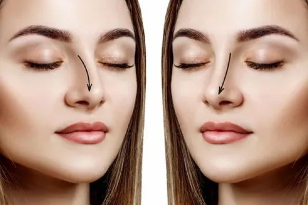 Rhinoplasty in Dubai: Redefining Facial Harmony Safely