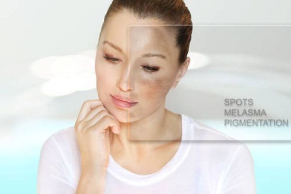 Best Pigmentation Treatment in Mumbai For Restore Even Skin Tone - Adore Skin Clinic