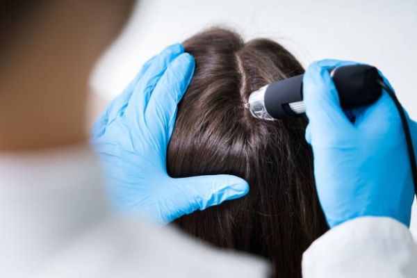 Exosome Hair in Dubai: Integrative Wellness Approach