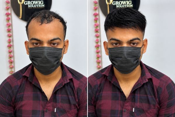 Hair Wig Store in Dwarka Delhi: Your Trusted Destination for Premium Hair Wigs